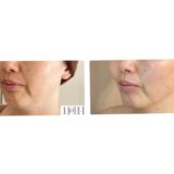 昔の顔に戻ってきてる！