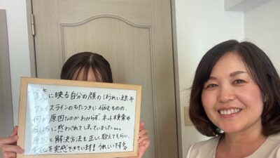 ほうれい線の解決方法を教えてもらったら、変化を実感できました