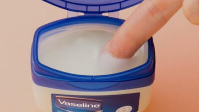 《Q＆A》ワセリンがほうれい線に効くって本当ですか？