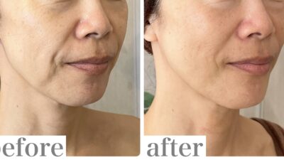 実は、ほうれい線が深くなる原因だった！〇〇の癖