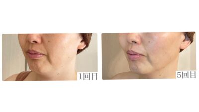 昔の顔に戻ってきてる！