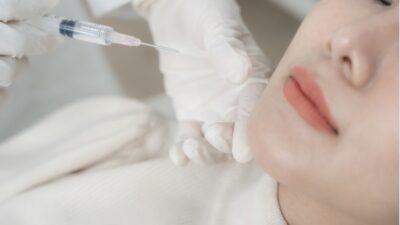 切開フェイスリフトをしようと決めていた