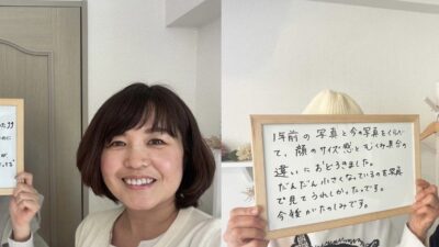ほうれい線はあっても仕方ない。本当にそう思いますか？